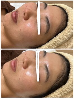 ジェニー(JENNI)/トロイピール　２回の変化