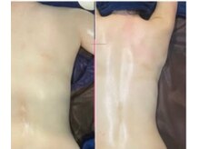 オーシャンブルーム 目黒(OceanBloom)/３ヶ月１０回ブライダル痩身