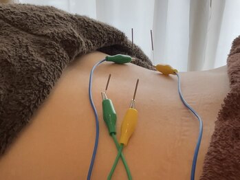 鍼灸 整体院 スズユ(SUZUYU)/【北浜/鍼灸/整体/腰痛改善】