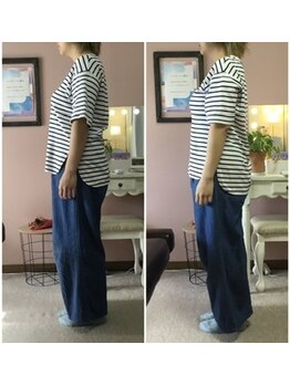 スマイル(smile)/before after 