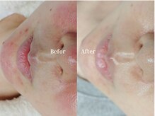 美肌を目指す方と二人三脚！しっかりサポートします