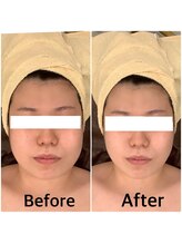 スペチアーレ 夙川/顔も気分も上げアゲに