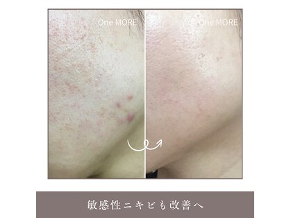 ワンモア(One MORE)の写真