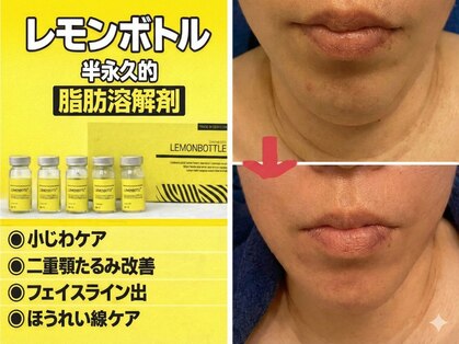 オンリーホープ(ONLY HOPE)の写真