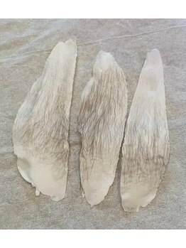 エステサロン桜/おでこの生え際もキレイ♪