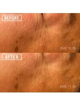 もみかる 静岡本店/二回でこの効果☆