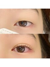 レッドモート(Red moat)/ダブルアイリフト