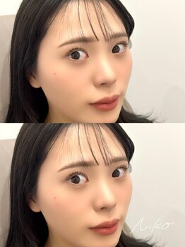 ニコ(Niko)の写真/<可愛いを作る/まつ毛&眉毛サロン>ナチュラル~ナチュラルボリュームまで対応!幅広いメニューも人気の理由♪