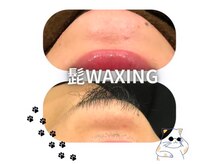 グルーミー(gloomy)/髭脱毛★men's脱毛★