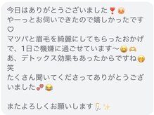 ソポ(sopo)/アフターフォロー