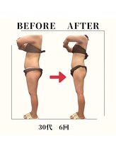 フェムビー 千葉駅前店(FEMBE)/痩身）30代の方の変化