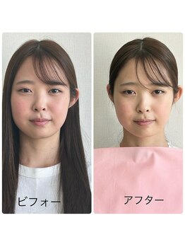 アルエット(Alouette)/ベストカラーで魅力UP