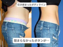 アンシャンテ 芦屋店/医師監修痩身　