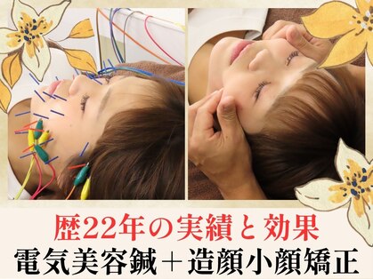 マッチ鍼灸整骨院の写真