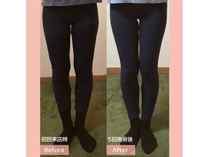 フェルナ(FERNA)の写真