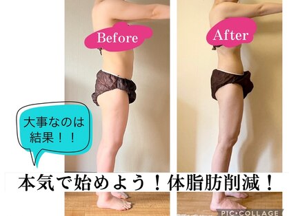 パーソナル本格痩身エステサロンYOSAPARK July 宮前平店の写真