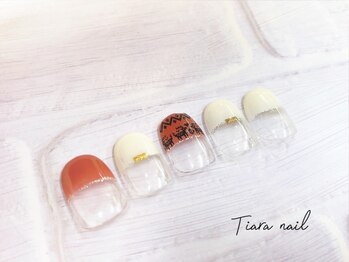 ティアラ(Tiara)/パラジェル 定額コース