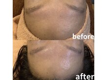 エステティック ボア(ESTHETIQUE BOITE)/