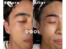 アリイ(Alii)/Cool