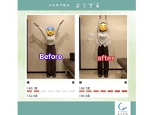 よくする 新潟市/お客様ビフォーアフター