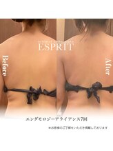 エスプリ 銀座店/痩身エステ銀座・セル脂肪対策