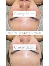 クレヴィー(Creviy)/REVlハーブピーリング