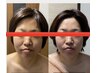 《生コラーゲンパック付☆》小顔コルギ70分