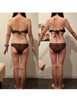 イロドリ 南浦和(irodori)/産後骨盤矯正Before＆After