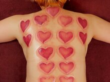 伊楽軒リラクゼーション 上野御徒町本店/アロマ＋カッピング