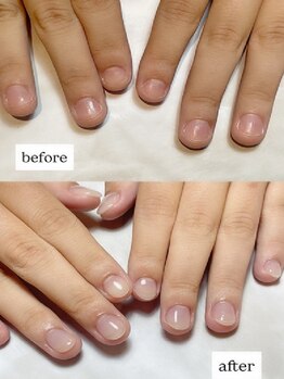 エンチューン(en.tune)の写真/爪が割れる、深爪や噛む癖、むしり癖…etc あらゆる爪の悩みを解消するための最適なサロンがここに★