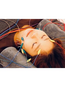 鍼灸施術を受けたい