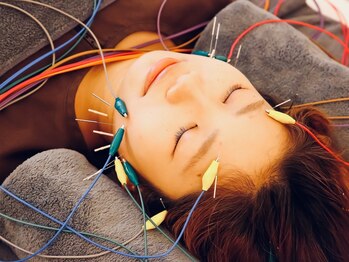 ユジュアンド(YUJ&)の写真/\少ない本数で最大限の効果を実感/電気を流す美容鍼を使用して表情筋の深層部に徹底アプローチ★