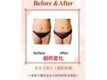 モア 多治見店(MORE)/お客様ビフォーアフター♪