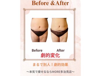 モア 多治見店(MORE)/お客様ビフォーアフター♪