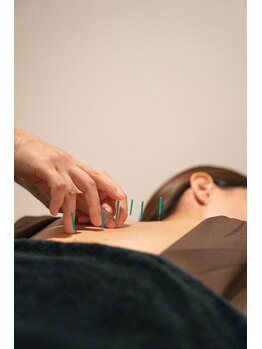 ケアフォー 日本橋(Carefor)/鍼灸で根本的なお悩みを撃退！