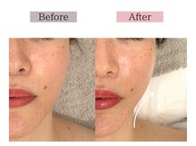 フロリール アザブジュウバン(FlorirAzabujuban)/全方位からリフトアップ