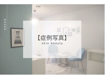 リフト 大宮(Lift)/小顔専門店Lift|Before After