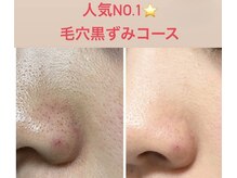 ティンク 心斎橋(Tink)