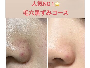 ティンク 心斎橋(Tink)