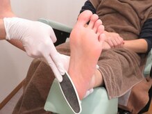 足のトラブルセンター 狸小路店/かかとの角質除去