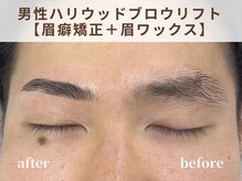 リルト(Re:lut)/男性ハリウッドブロウリフト