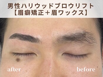 リルト(Re:lut)/男性ハリウッドブロウリフト