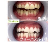 ルブラン 奈良店(Le Blanc)/白は爽やかなイメージ！！