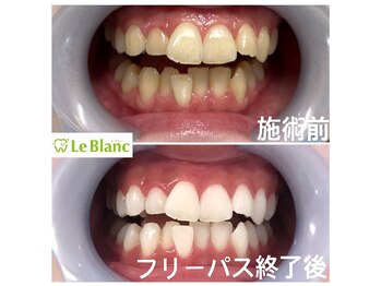 ルブラン 奈良店(Le Blanc)/白は爽やかなイメージ!!