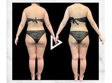 エステティック エイチアンドビー 大和店(H&B)/ビフォーアフター