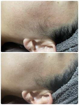 ビューティーホームサロン(Beauty Home Salon)/顔脱毛