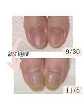 シープラス/クリアジェルで自爪育成