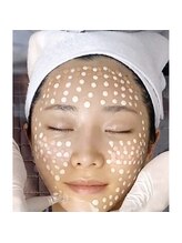 ジュエッテ(jouete)/BB glow 