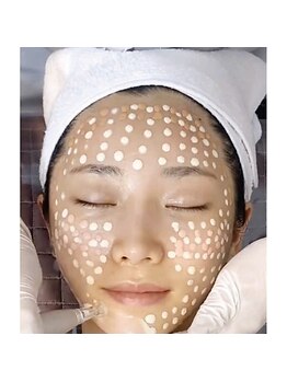 ジュエッテ(jouete)/BB glow 