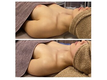 ベンザイ 梅田店(BENZAI)/バストUP